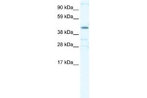 WB Suggested Anti-YY1 Antibody Titration:  0. (YY1 抗体  (Middle Region))