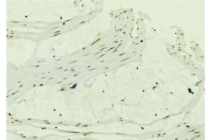 ABIN6279318 at 1/100 staining Mouse muscle tissue by IHC-P. (CCDC8 抗体  (N-Term))