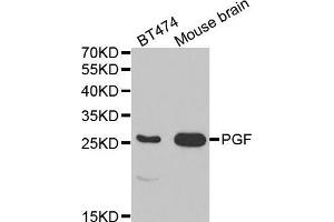 Western blot analysis of extracts of various cell lines, using PGF antibody. (PLGF 抗体  (AA 19-170))