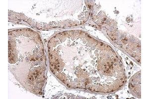 Immunohistochemistry (IHC) image for anti-Androgen Receptor (AR) (N-Term) antibody (ABIN2857043)