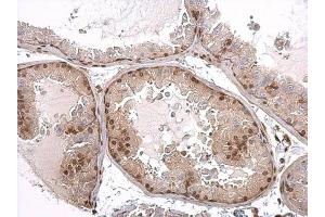 IHC-P Image Androgen Receptor antibody [N1], N-term detects Androgen Receptor protein at nucleus on mouse prostate by immunohistochemical analysis.