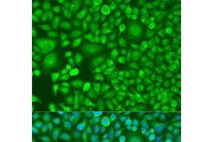 Immunofluorescence analysis of U2OS cells using RARB Polyclonal Antibody at dilution of 1:100. (Retinoic Acid Receptor beta 抗体)