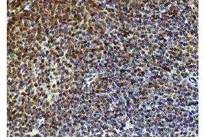IHC analysis of Rad9/Rad9a using anti-Rad9/Rad9a antibody (ABIN7599342).
