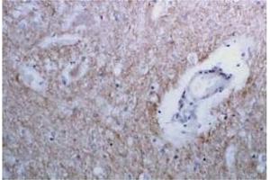 Immunohistochemistry (IHC) image for anti-Syntaxin 1A (Brain) (STX1A) antibody (ABIN492371) (STX1A 抗体)