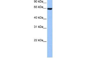 WB Suggested Anti-COL4A3BP Antibody Titration: 0. (COL4A3BP 抗体  (N-Term))