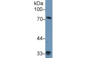Western Blot; Sample: Human Lung lysate; Primary Ab: 1µg/ml Rabbit Anti-Human ZYX Antibody Second Ab: 0. (ZYX 抗体  (AA 377-523))