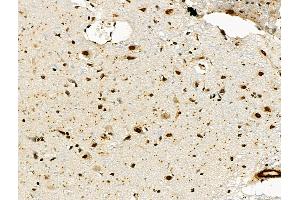 ABIN6260618 and ABIN6276638 at 1/100 staining Rat brain tissue by IHC-P. (CD3D 抗体  (Internal Region))