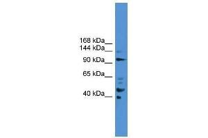 PIBF1 antibody used at 0. (PIBF1 抗体  (C-Term))