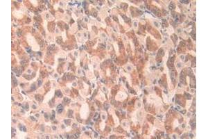 Immunohistochemistry (IHC) image for anti-Angiopoietin-Like 2 (ANGPTL2) (AA 267-493) antibody (ABIN7434344)