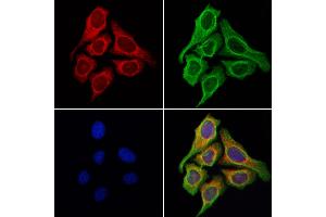 ABIN6258195 and ABIN6276040 staining Hela cells by IF/ICC. (GPR87 抗体  (Internal Region))