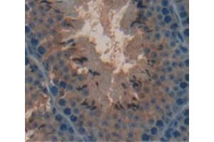 IHC-P analysis of Mouse Tissue, with DAB staining. (COMP 抗体  (AA 40-180))
