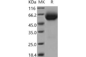 Western Blotting (WB) image for Interleukin 18 Receptor 1 (IL18R1) protein (His tag) (ABIN7196446) (IL18R1 Protein (His tag))