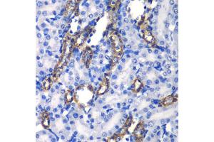 Immunohistochemistry of paraffin-embedded rat kidney using MATK antibody. (MATK 抗体)