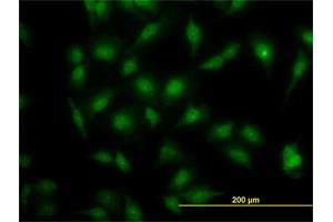 Immunofluorescence of monoclonal antibody to MAPK3 on HeLa cell. (ERK1 抗体  (AA 279-379))