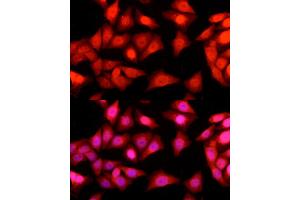 Immunofluorescence (IF) image for anti-Ataxin 3 (ATXN3) (AA 1-364) antibody (ABIN3021829)