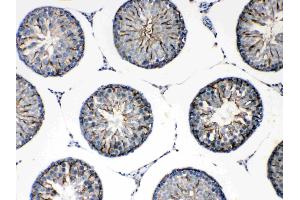 IHC analysis of FMN1 using anti-FMN1 antibody . (FMN1 抗体  (AA 1195-1419))