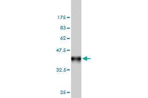 Western Blot detection against Immunogen (36. (FHIT 抗体  (AA 31-130))