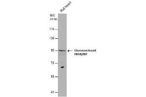WB Image Glucocorticoid receptor antibody detects Glucocorticoid receptor protein by western blot analysis. (Glucocorticoid Receptor 抗体  (N-Term))