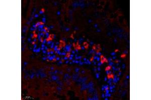 Immunofluorescence (Paraffin-embedded Sections) (IF (p)) image for anti-Tumor Necrosis Factor Receptor Superfamily, Member 6b, Decoy (TNFRSF6B) antibody (ABIN7076071)