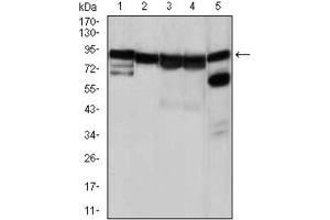 Western Blotting (WB) image for anti-Heat Shock Protein 90kDa alpha (Cytosolic), Class A Member 1 (HSP90AA1) antibody (ABIN1843961) (HSP90AA1 抗体)