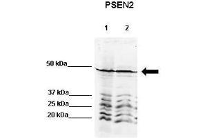 WB Suggested Anti-PSEN2 Antibody    Positive Control:  Lane 1: 80ug rat brain extract Lane 2: 80ug mouse brain extract  Primary Antibody Dilution :   1:500  Secondary Antibody :  IRDye 800 CW goat anti-rabbit from Li-COR Bioscience  Secondry Antibody Dilution :   1:20,000  Submitted by:  Dr. (Presenilin 2 抗体  (N-Term))