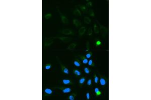 Immunofluorescence analysis of MCF7 cell using UGT1A9 antibody. (UGT1A9 抗体)