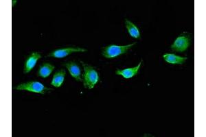 Immunofluorescent analysis of A549 cells using ABIN7150570 at dilution of 1:100 and Alexa Fluor 488-congugated AffiniPure Goat Anti-Rabbit IgG(H+L) (DOK3 抗体  (AA 1-146))