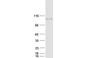 Western Blotting (WB) image for Extended Synaptotagmin 2 (ESYT2) protein (Myc-DYKDDDDK Tag) (ABIN2720640)