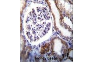IFT88 Antibody (C-term) (ABIN655090 and ABIN2844723) immunohistochemistry analysis in formalin fixed and paraffin embedded human kidney tissue followed by peroxidase conjugation of the secondary antibody and DAB staining.