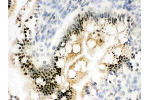 IHC analysis of RbAp48 using anti-RbAp48 antibody . (Retinoblastoma Binding Protein 4 抗体  (C-Term))