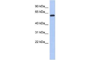 WB Suggested Anti-KLHL7 Antibody Titration: 0. (KLHL7 抗体  (Middle Region))