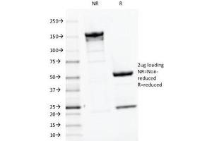 SDS-PAGE Analysis of Purified, BSA-Free PTH Antibody (clone PTH/1175). (PTH 抗体  (AA 32-115))