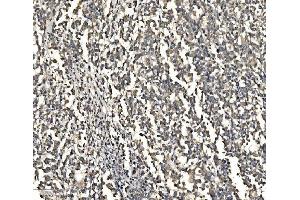 IHC analysis of ATG9A using anti-ATG9A antibody (ABIN7600676). (ATG9A 抗体  (AA 22-169))