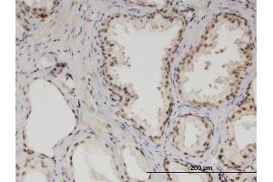 Immunoperoxidase of monoclonal antibody to MED6 on formalin-fixed paraffin-embedded human prostate. (MED6 抗体  (AA 1-246))