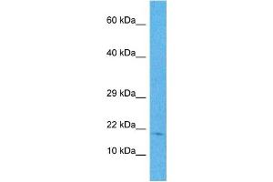 Western Blotting (WB) image for anti-NADH Dehydrogenase (Ubiquinone) 1 beta Subcomplex, 11, 17.3kDa (NDUFB11) (N-Term) antibody (ABIN5517203)