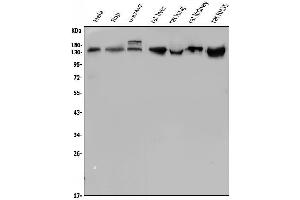 Western blot analysis of LDLR using anti-LDLR antibody (ABIN7601438).