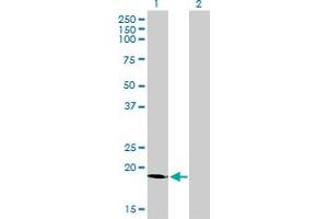 Western Blot analysis of SSR4 expression in transfected 293T cell line by SSR4 monoclonal antibody (M01), clone 2D3. (SSR4 抗体  (AA 24-173))