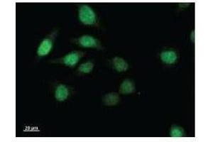 Immunostaining analysis in HeLa cells. (TWIST1 抗体)