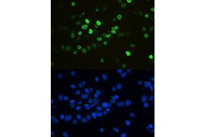 IF analysis of HnRNPF using anti-HnRNPF antibody (ABIN4886622).