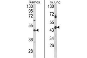 (LEFT) Western blot analysis of CXCR7 Antibody (C-term) in Ramos cell line lysates (35ug/lane). (CXCR7 抗体  (C-Term))