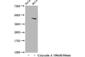 Western Blot Positive WB detected in Hela whole cell lysate(treated with Calyculin A or not) All lanes Phospho-MAPT antibody at 1. (Recombinant MAPT 抗体  (pThr231))