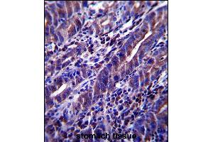 MUC1/E Antibody (C-term) (ABIN657546 and ABIN2846561) immunohistochemistry analysis in forlin fixed and paraffin embedded hun stoch tissue followed by peroxidase conjugation of the secondary antibody and DAB staining. (MUC1 抗体  (C-Term))