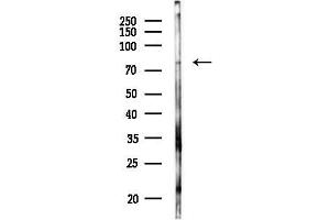 anti-Chloride Intracellular Channel 6 (CLIC6) (Internal Region) antibody