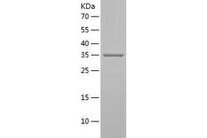 SRR Protein (AA 1-340) (His tag)