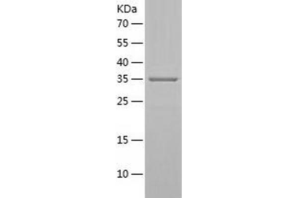 SRR Protein (AA 1-340) (His tag)