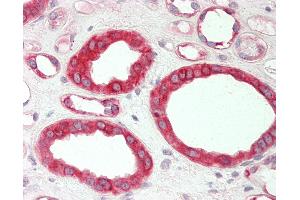 Human Kidney: Formalin-Fixed, Paraffin-Embedded (FFPE). (HMGCS1 抗体  (C-Term))