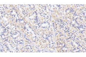 Detection of THBS2 in Human Stomach Tissue using Polyclonal Antibody to Thrombospondin 2 (THBS2) (Thrombospondin 2 抗体  (AA 968-1172))