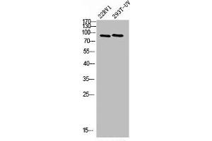 Western Blot analysis of 293T-UV 22RV1 cells using PML Polyclonal Antibody (PML 抗体  (N-Term))