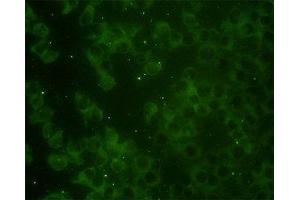 Image no. 3 for anti-RAP2B, Member of RAS Oncogene Family (RAP2B) (AA 1-184) antibody (ABIN598571) (RAP2B 抗体  (AA 1-184))