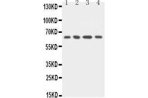 Anti-uPA Receptor antibody, Western blotting Lane 1: MCF-7 Cell Lysate Lane 2: HELA Cell Lysate Lane 3: RAJI Cell Lysate Lane 4: SMMC Cell Lysate (PLAUR 抗体  (C-Term))